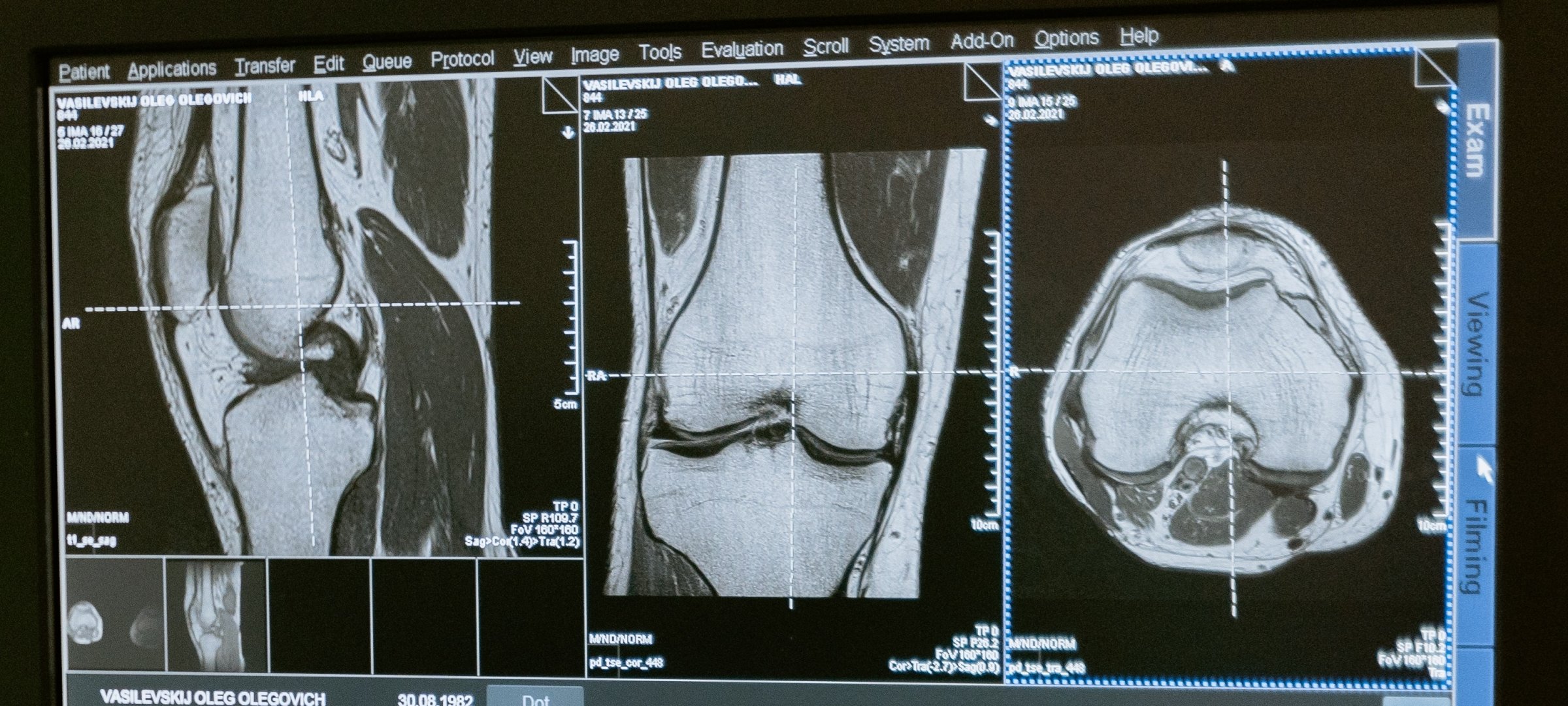 medical imaging phd position