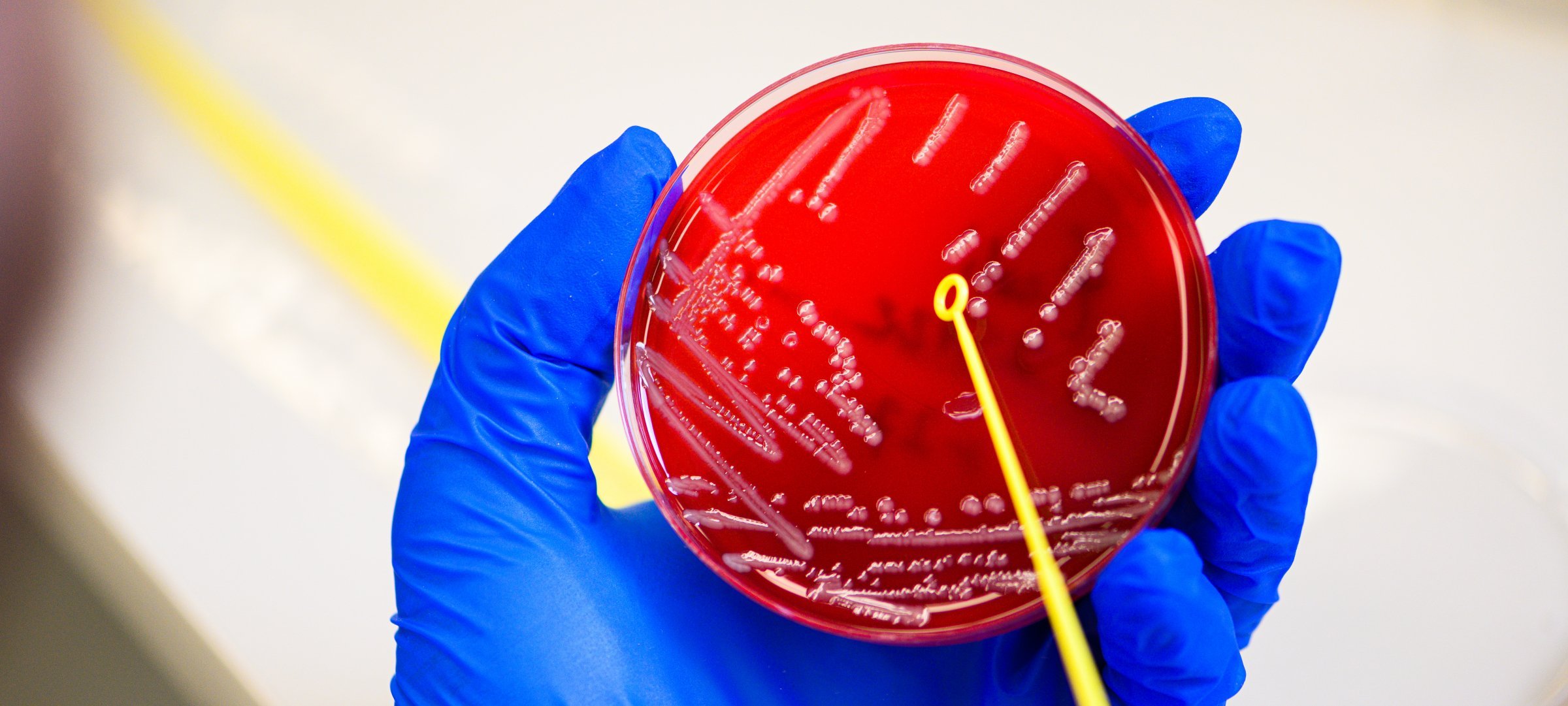 Student researcher holding a petri dish with speciman.