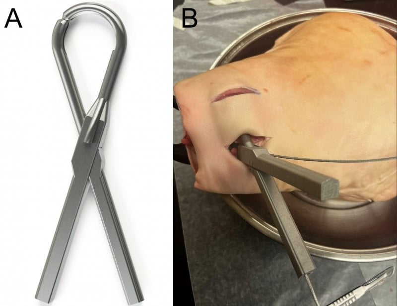 Minimally-Invasive (MIS) Cable Passer Project Photo